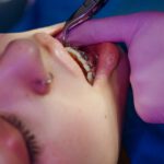 zalety aparatu ortodontycznego