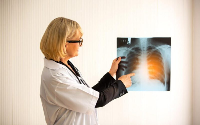 Jakimi chorobami zajmuje się pulmonolog?
