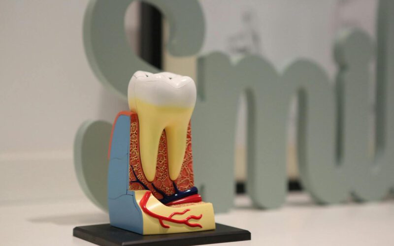 Objawy martwicy zęba – kiedy udać się do dentysty?